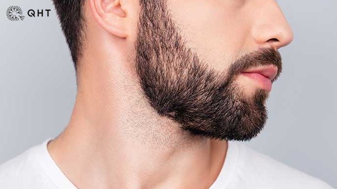 Beard Hair Transplant: A Step-by-Step Guide to the Procedure