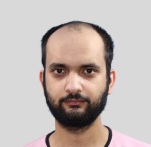 Hair Transplant in Bangalore