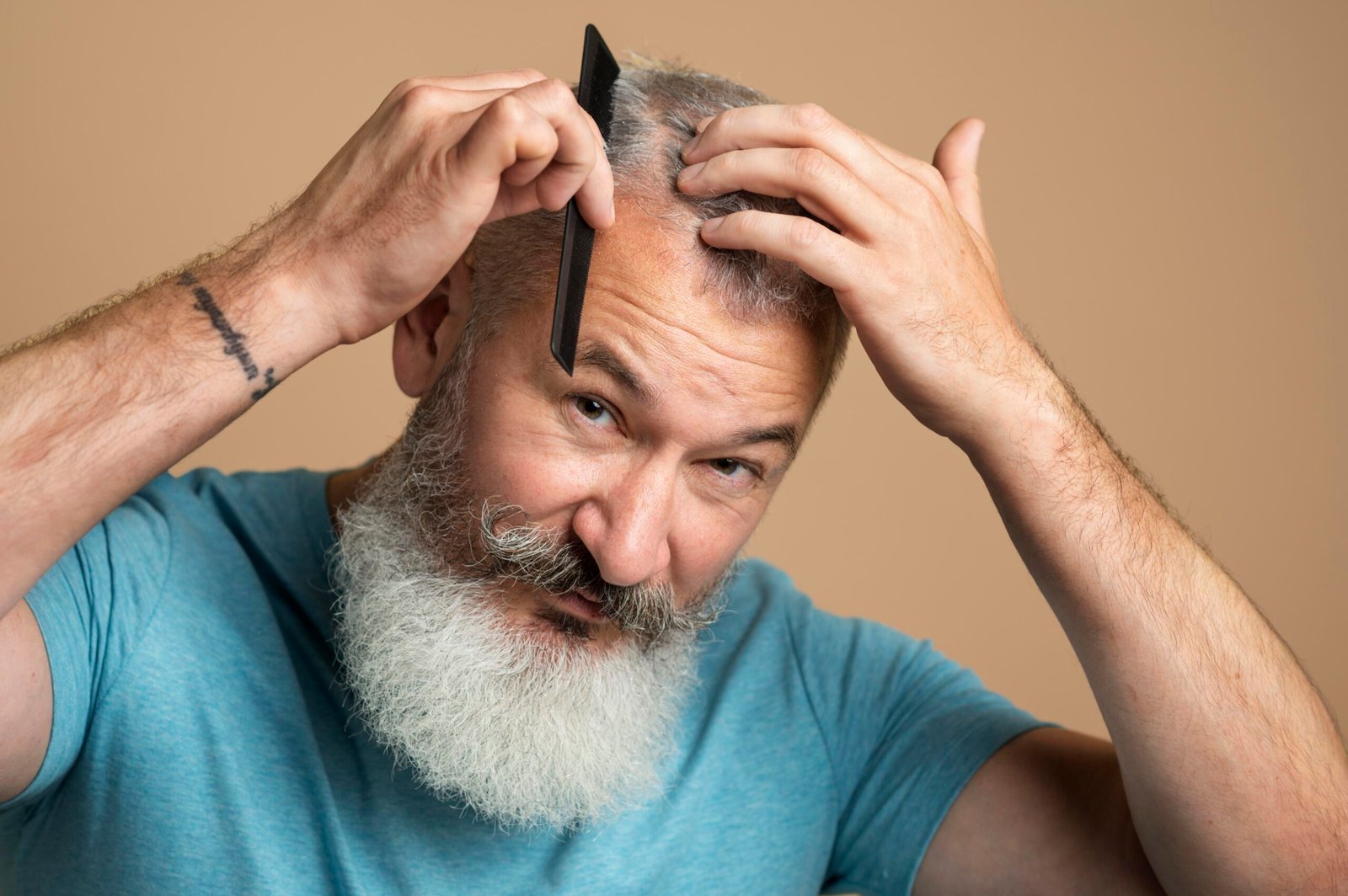 What is a Synthetic Hair Transplant