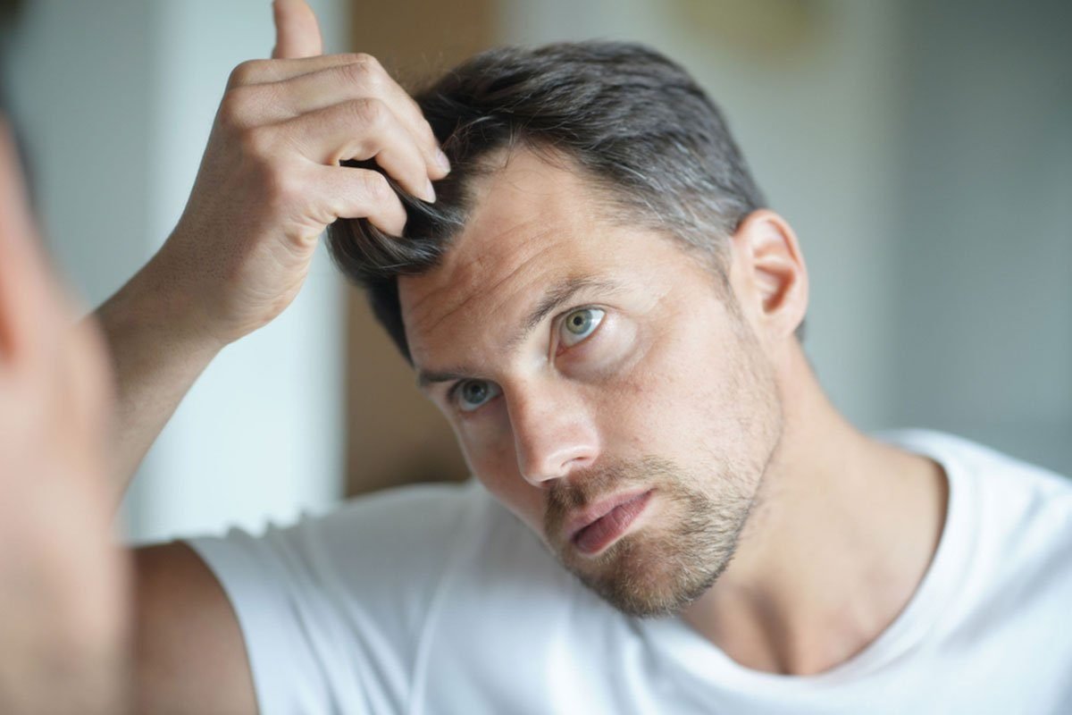 Why Do Some Hair Transplants Fail?