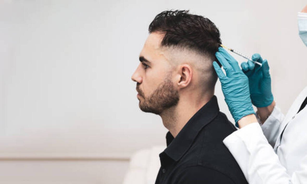 How long does PRP last for hair?