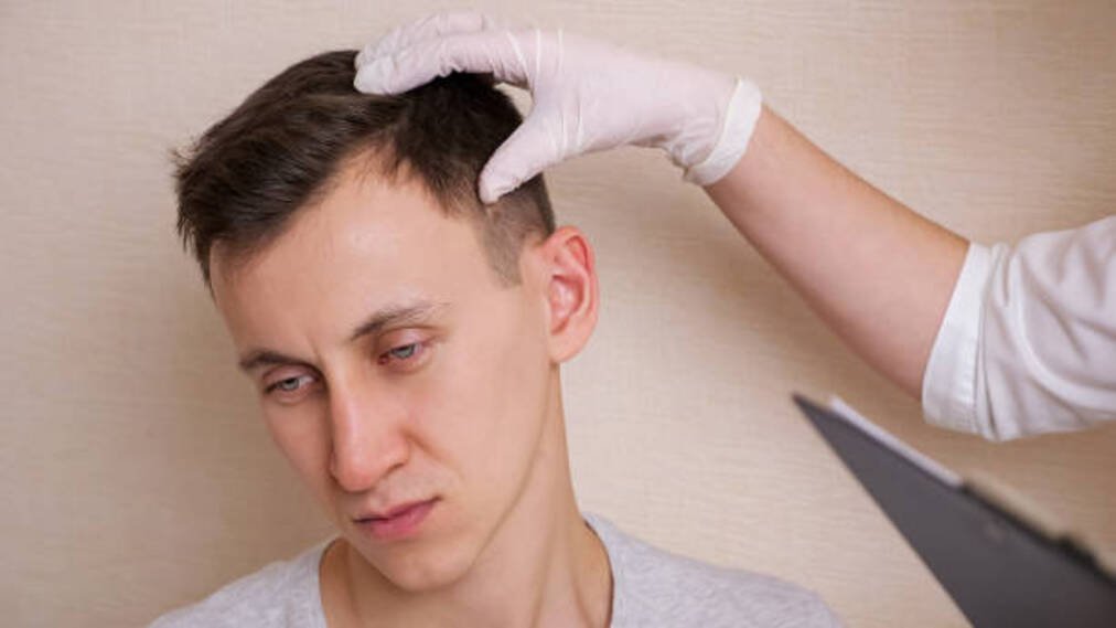 Why Choose FUE Hair Transplant? Top 10 Benefits