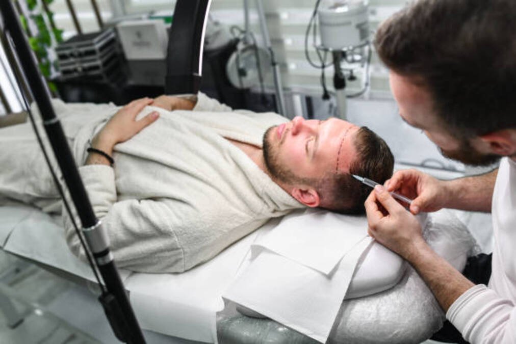 FUE Hair Transplant – Procedure Cost Benefits & Results Explained