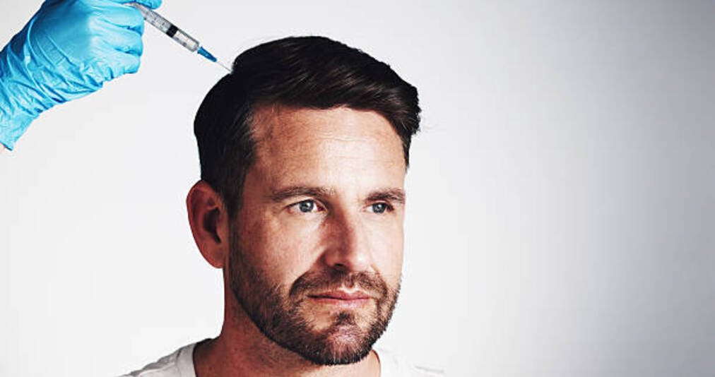 PRP Hair Treatment Benefits