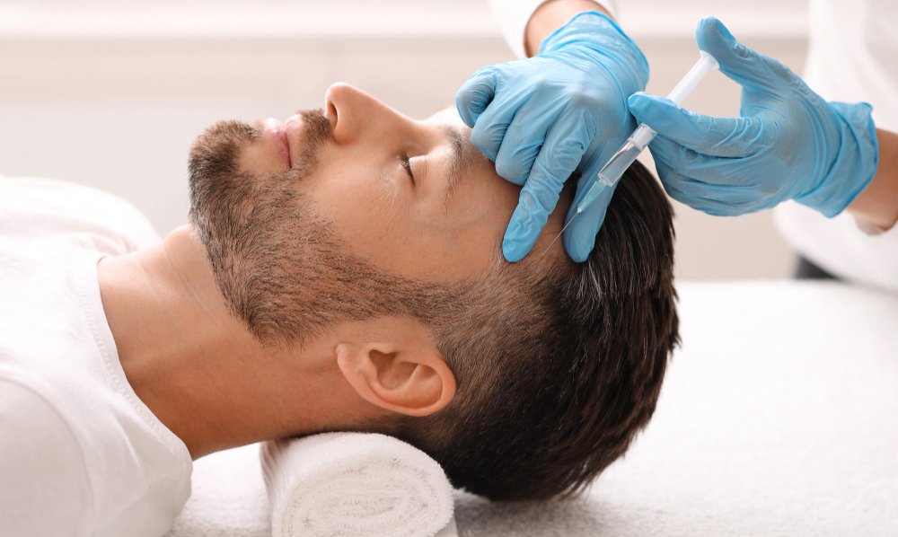 Hair Transplant Before and After Results Explained