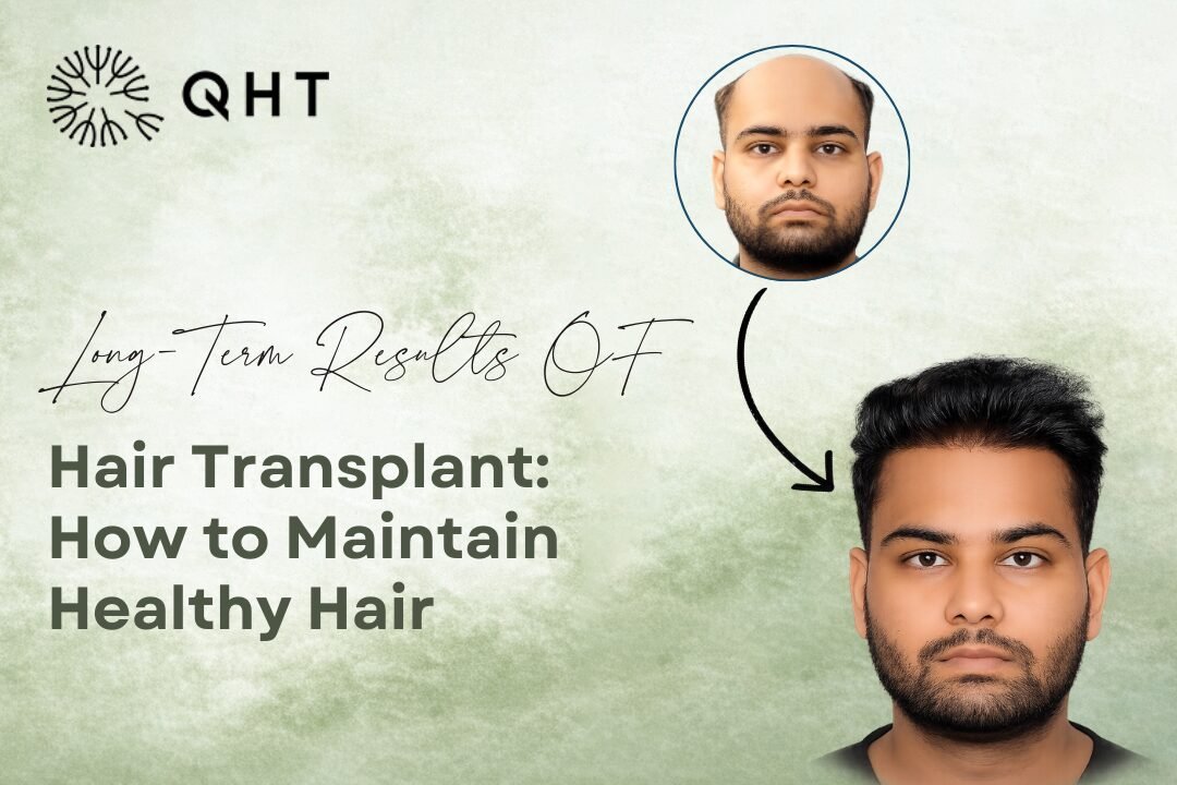 Hair Transplant Care
