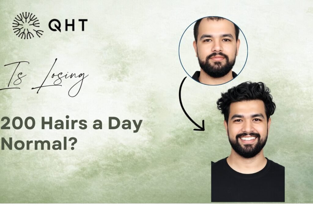 how much daily hair loss is normal