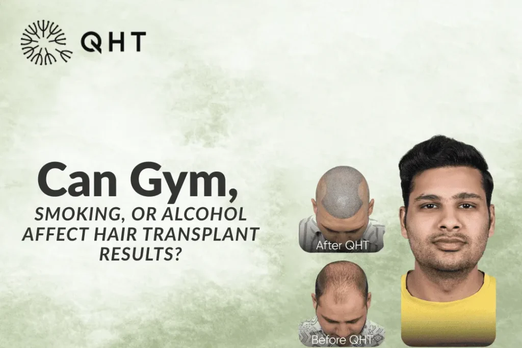 Can Gym, Smoking, or Alcohol Affect Hair Transplant Results?