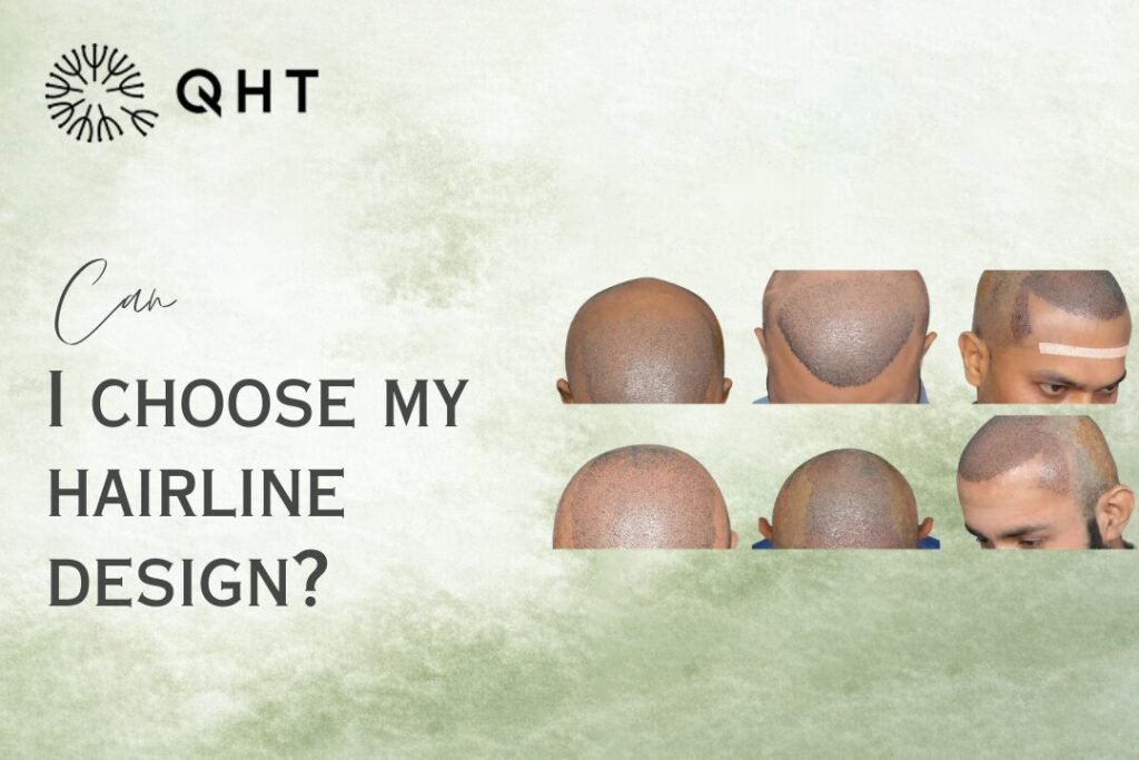 Hairline design hair transplant