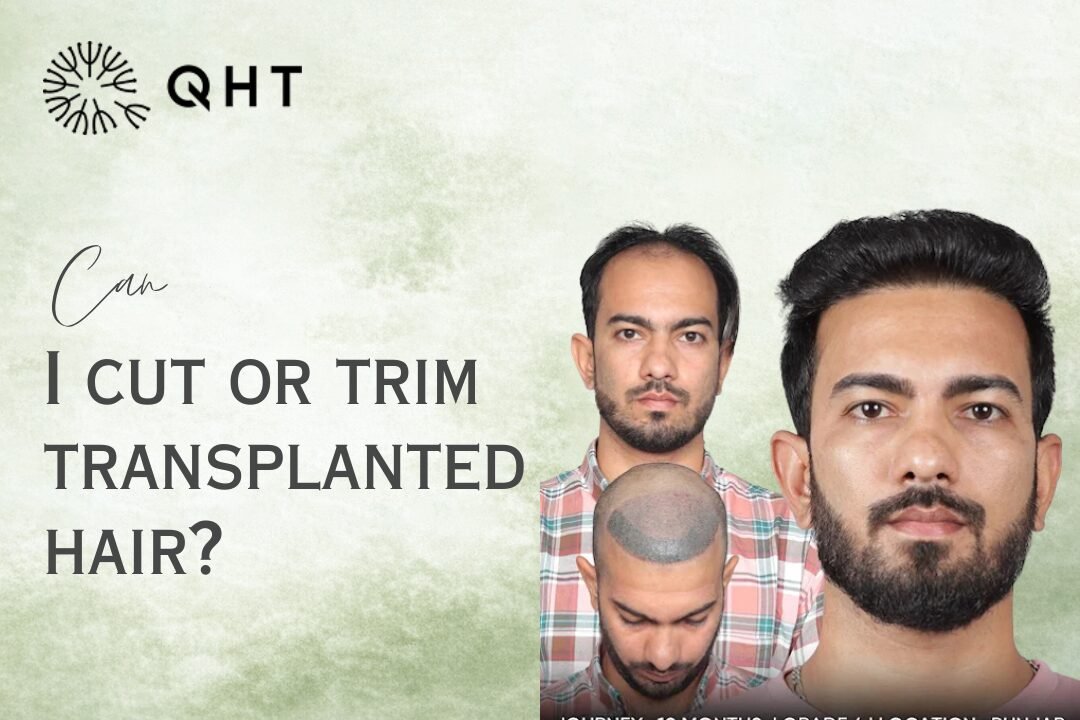 Cutting Hair After Hair Transplant