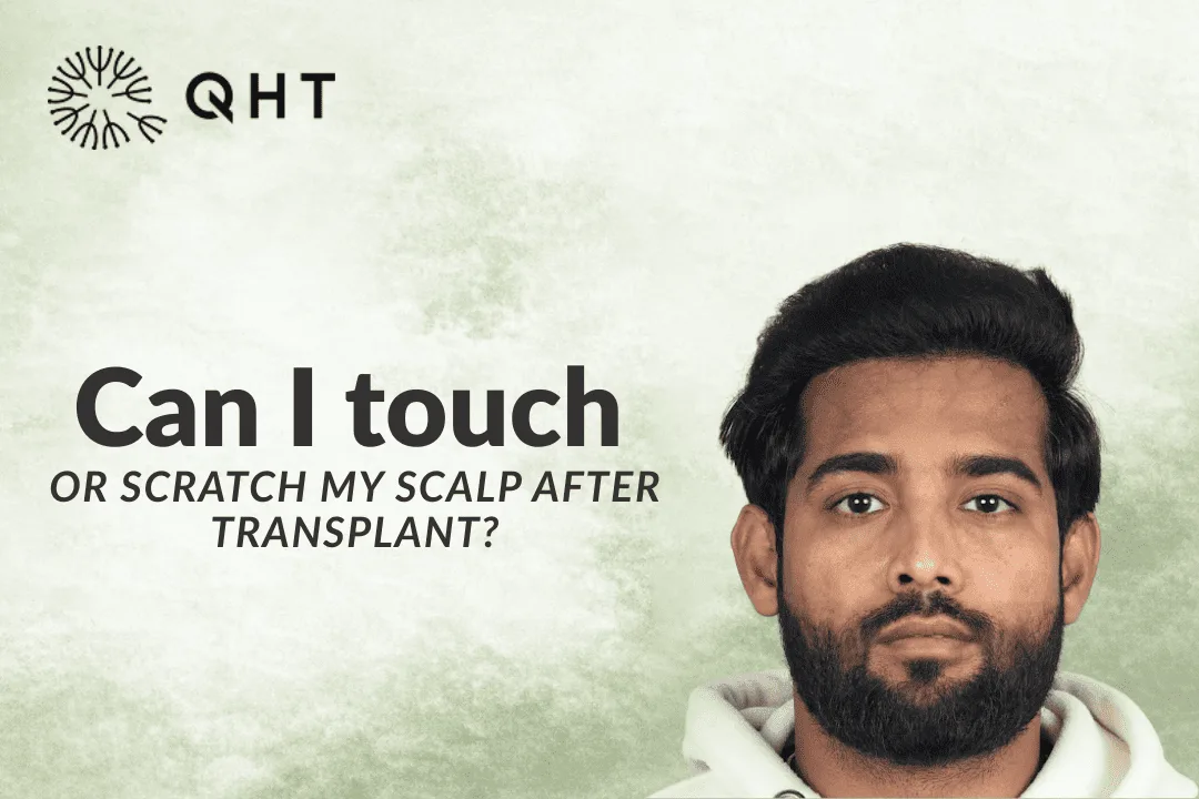 Can I touch or scratch my scalp after transplant?