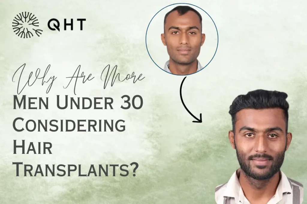 Hair transplant under 30