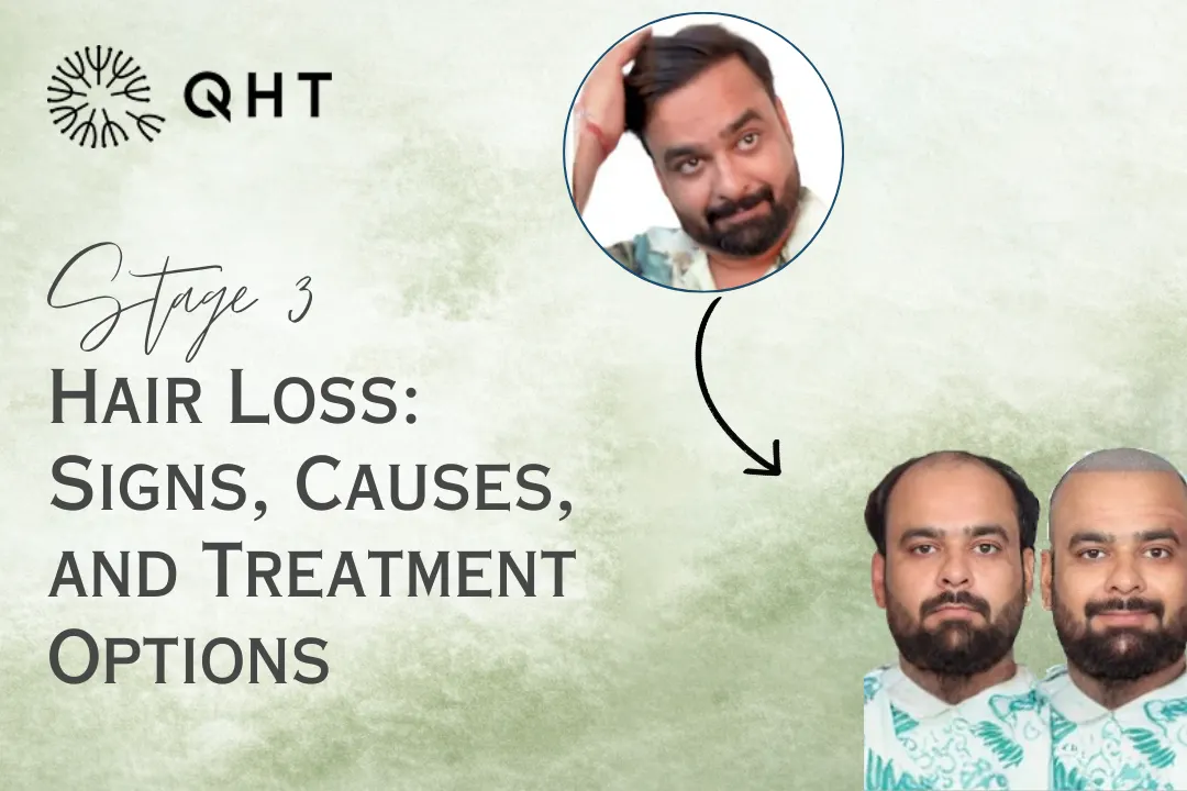 Hair Loss: Signs, Causes and Treatment Options