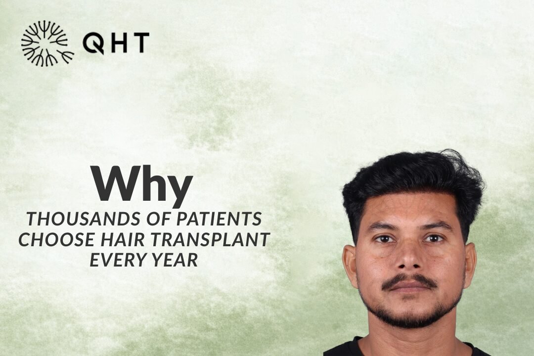 Why Thousands of Patients Choose Hair Transplant Every Year