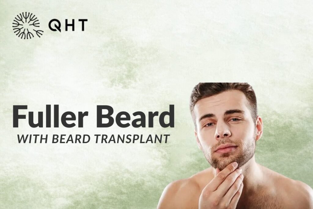 beard transplant