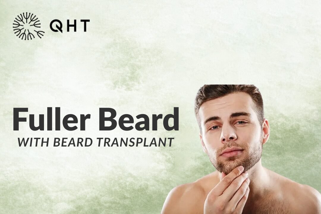 Fuller Beard with Beard Transplant