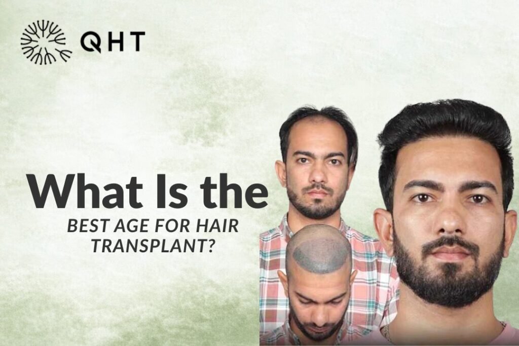 Best Age For Hair Transplant