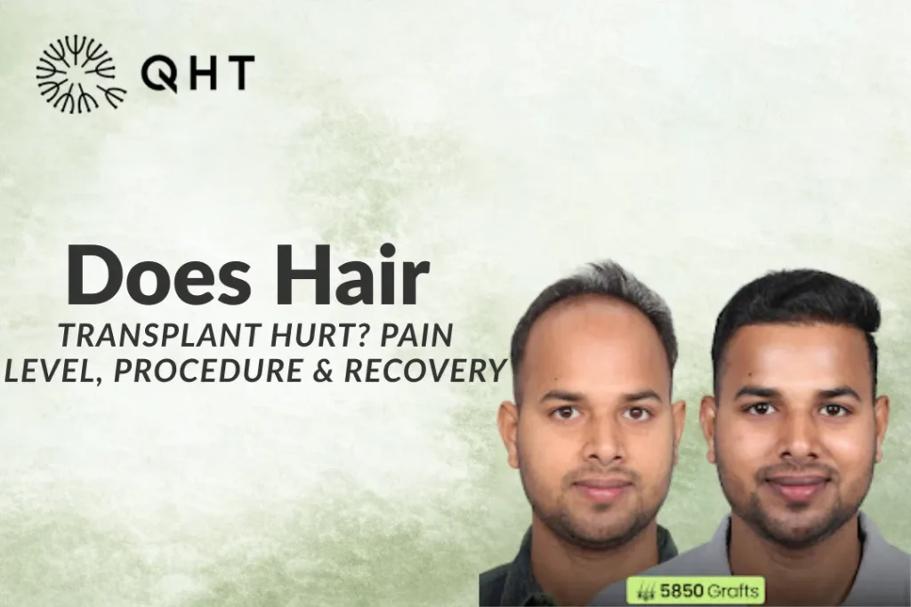 Does hair transplant hurt