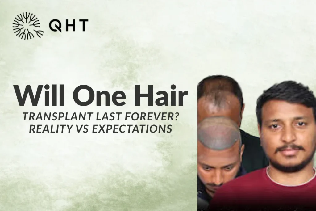 Is One Hair Transplant Enough? Reality vs Expectations
