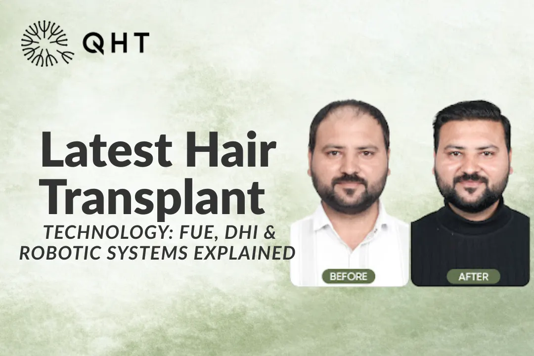 Latest Hair Transplant Technology: FUE, DHI & Robotic Systems Explained