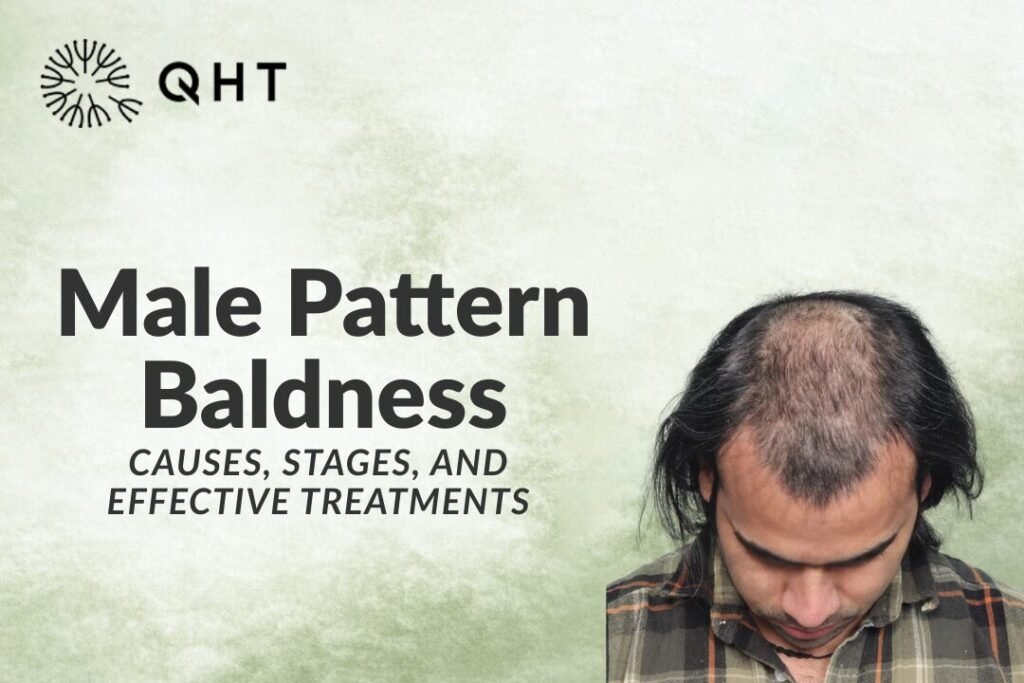 Male Pattern Baldness: Causes, Stages, and Effective Treatments