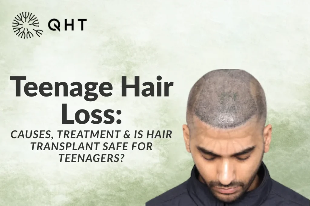 Teenage hair loss