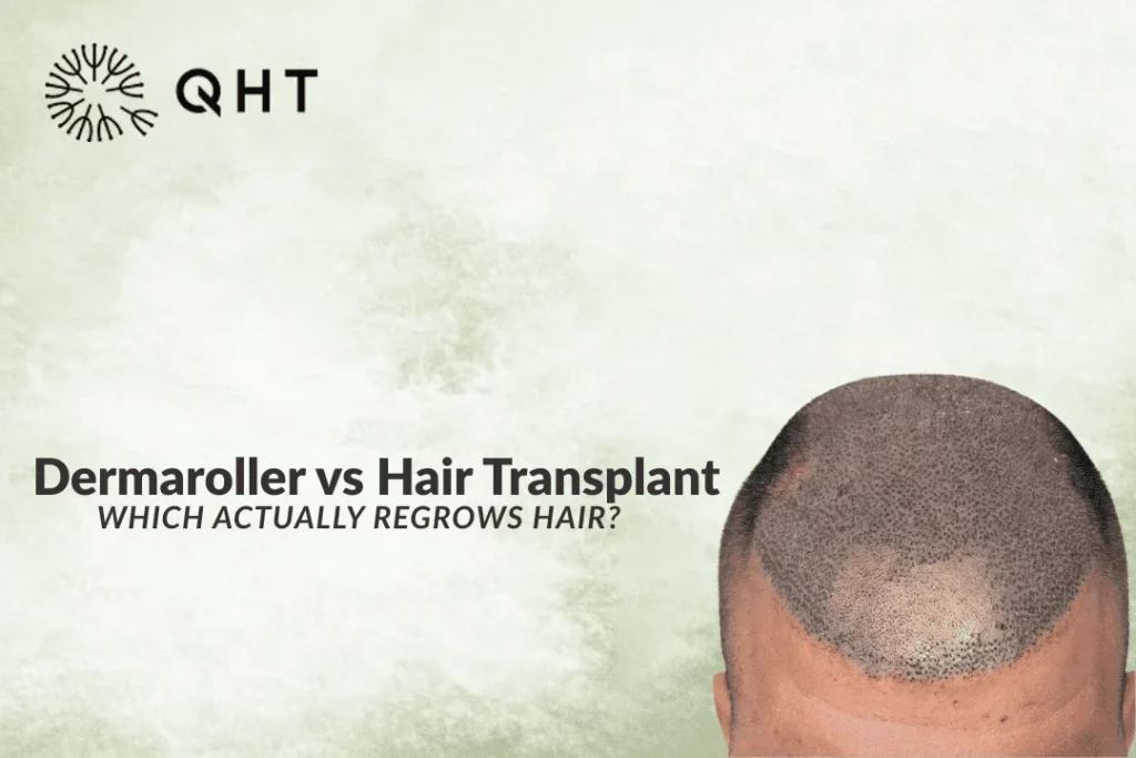 Dermaroller vs Hair Transplant: Which One Actually Works for Hair Regrowth?