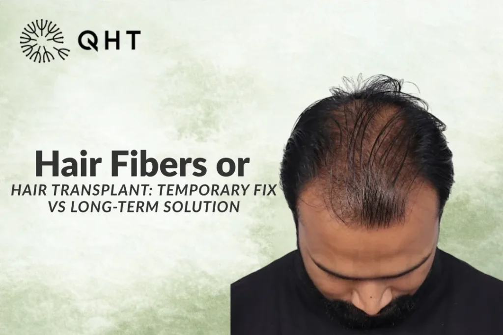 Hair Fibers or Hair Transplant: Temporary Fix vs Long-Term Solution