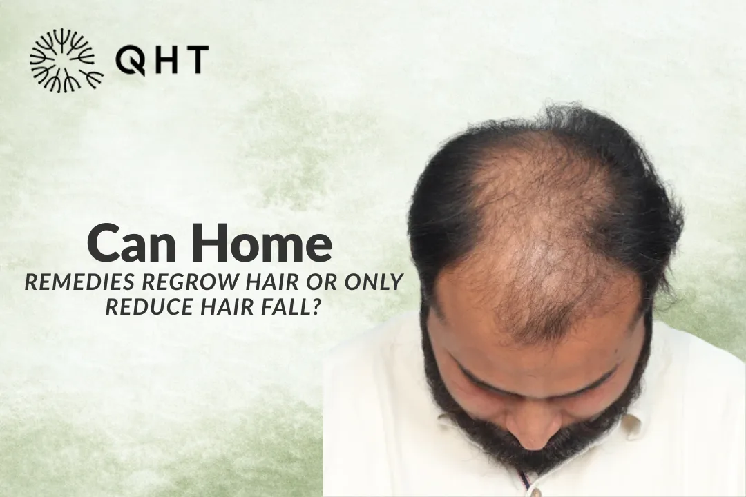 Can Home Remedies Regrow Hair or Only Reduce Hair Fall