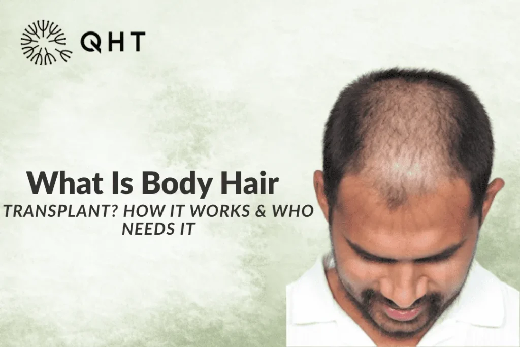 Body Hair Transplant