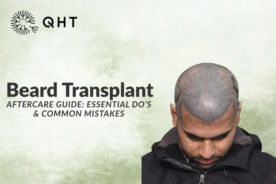 Beard Transplant Aftercare Guide: Essential Do’s & Common Mistakes