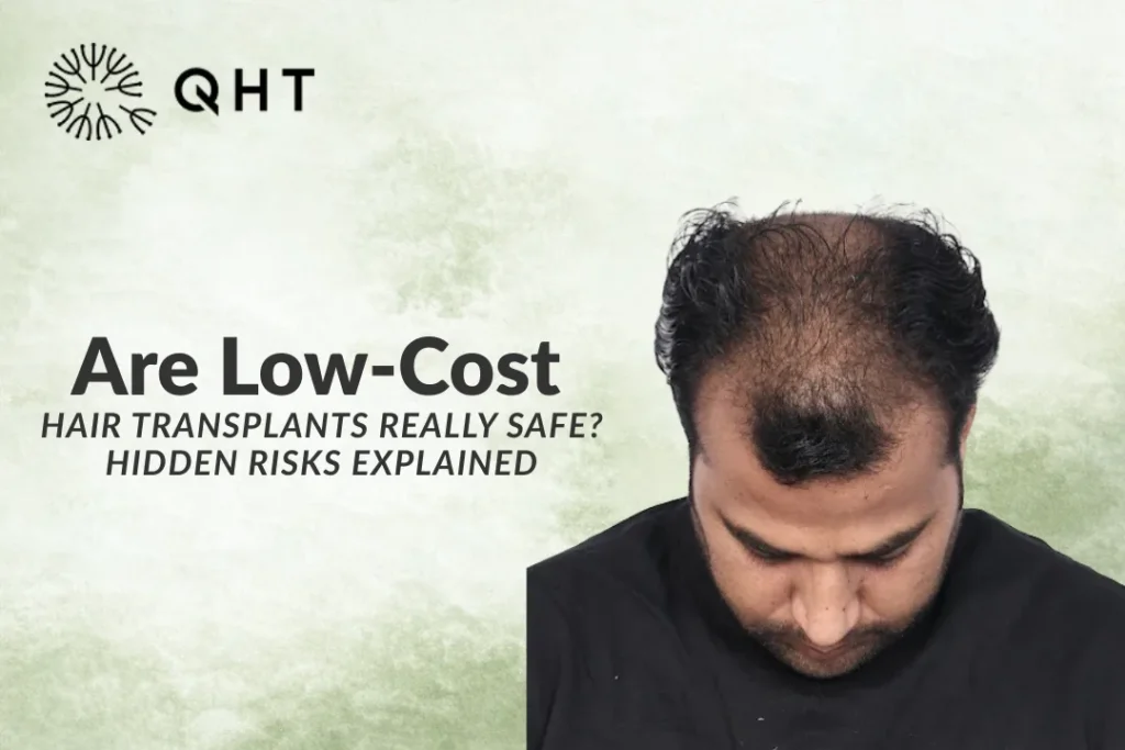 Are Low-Cost Hair Transplants Really Safe? Hidden Risks Explained