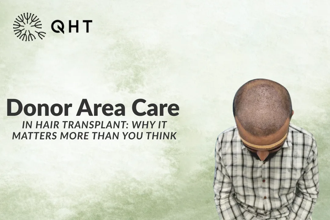 Donor Area Care in Hair Transplant: Why It Matters More Than You Think