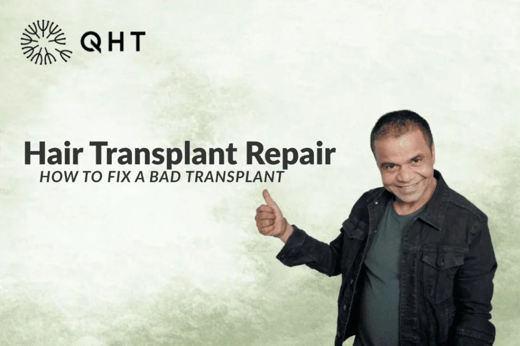Hair Transplant Repair: How to Fix a Bad Hair Transplant