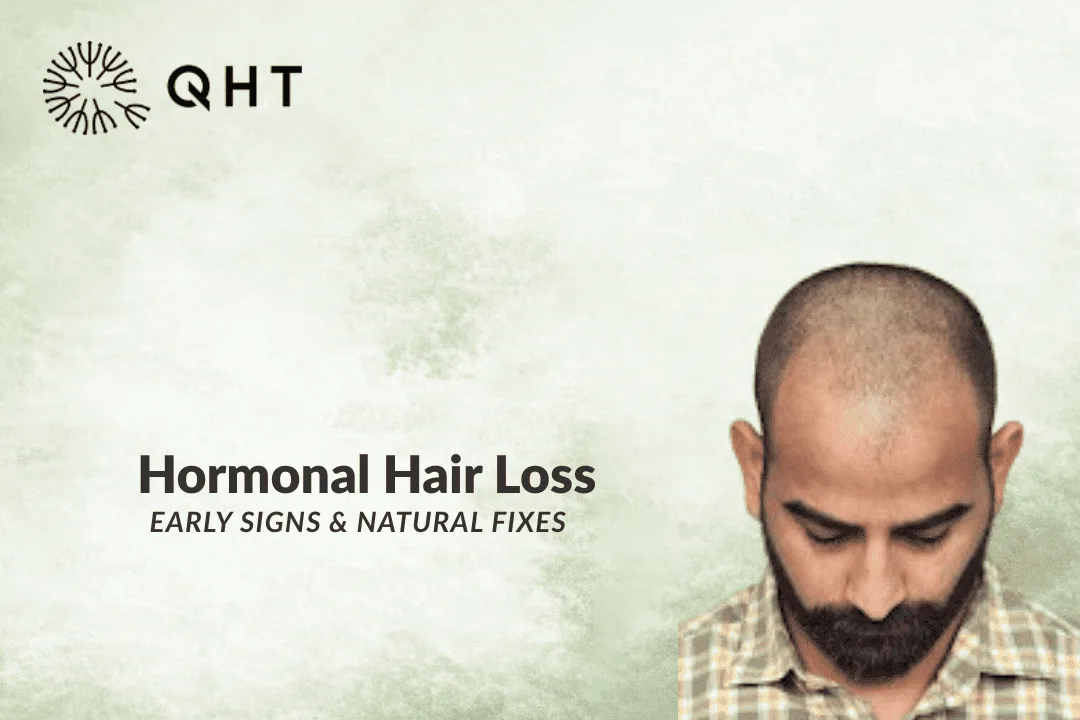Hormonal Hair Loss: Causes, Early Signs & How to Stop It Naturally