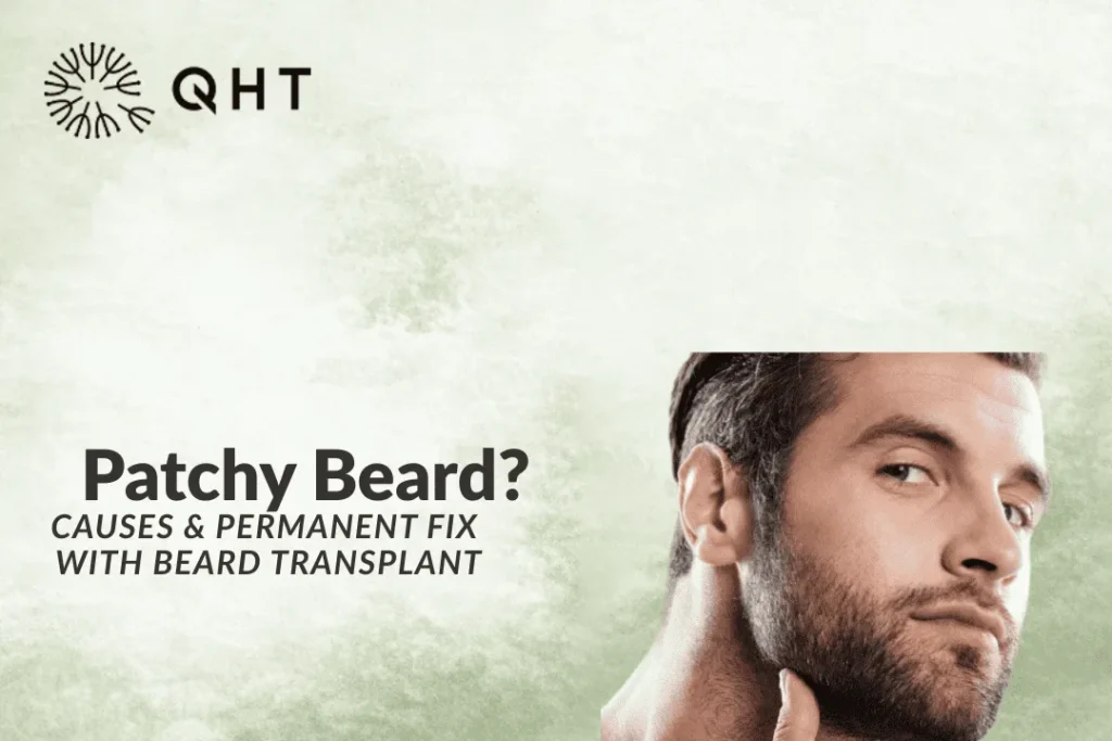 Why Is My Beard Patchy? Causes & How Beard Transplant Can Fix It Permanently