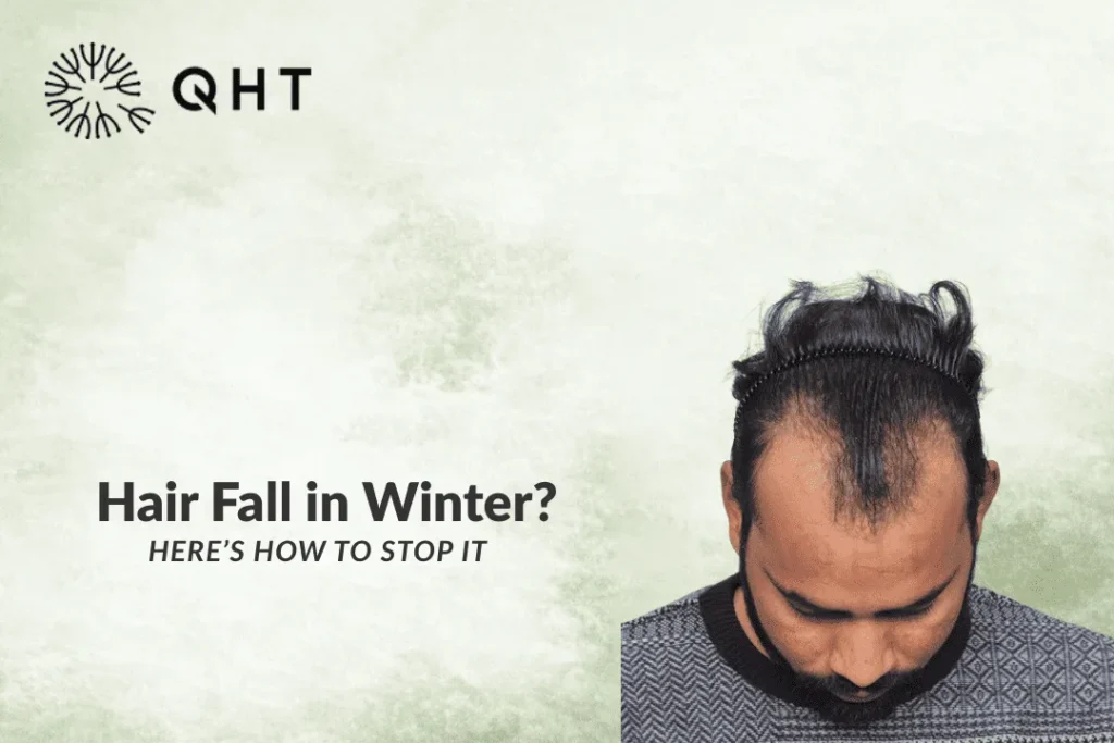 Winter Hair Fall: Causes, Solutions and Tips