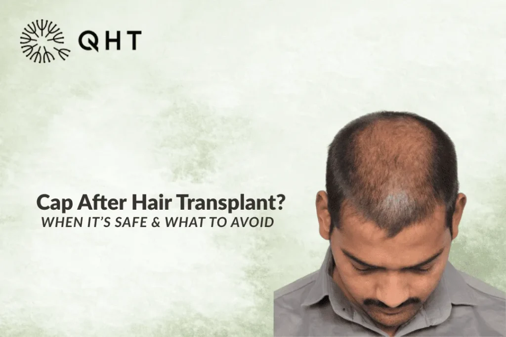 cap after hair transplant