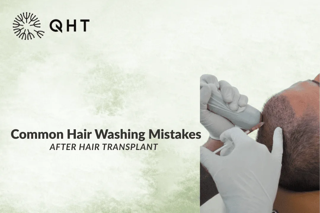 When Can You Wash Your Hair After a Hair Transplant? Full Timeline & Guide