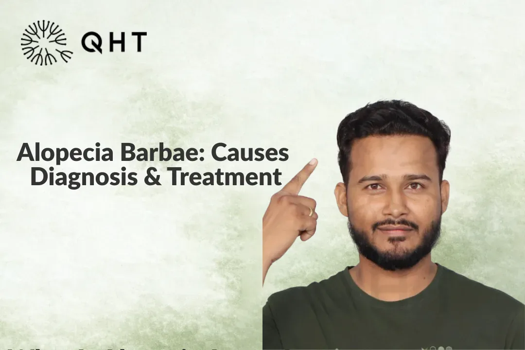 Understanding Alopecia Barbae: Diagnosis, Causes & Recovery