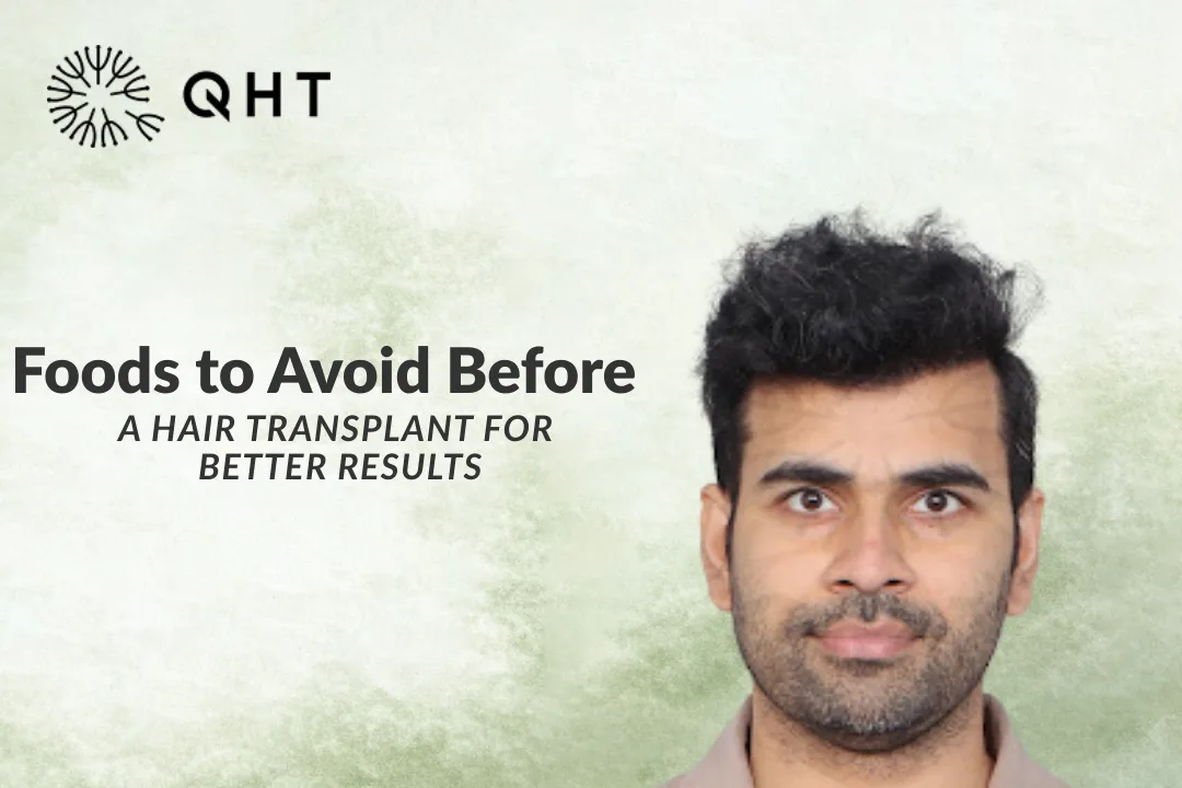 Foods to Avoid Before a Hair Transplant for Better Results