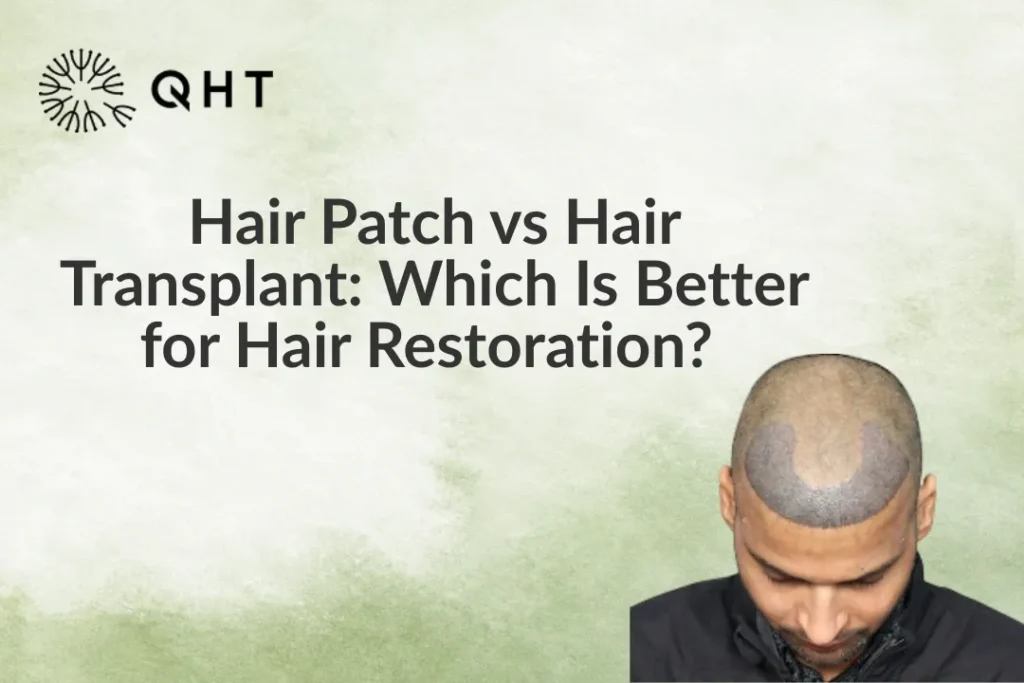 Hair Patch vs Hair Transplant: Which Is Better for Hair Restoration?