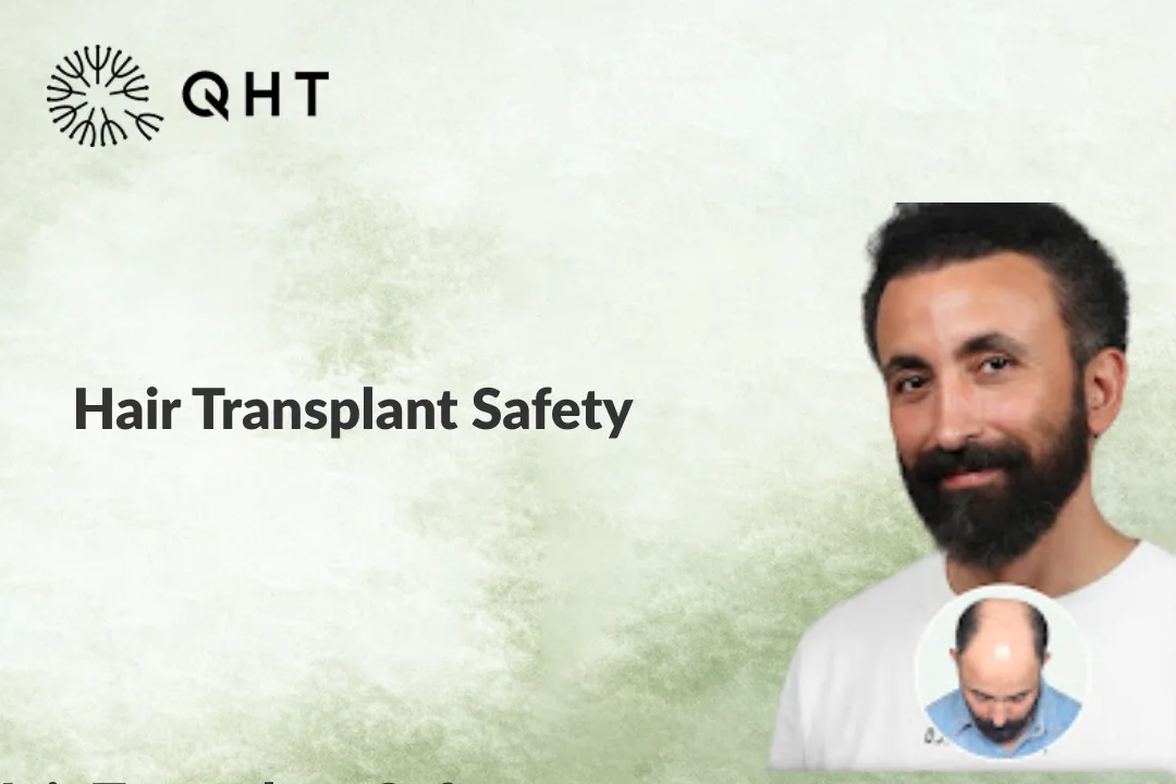 Hair Transplant Safety: Understanding Hair Transplants Risks Before Treatment