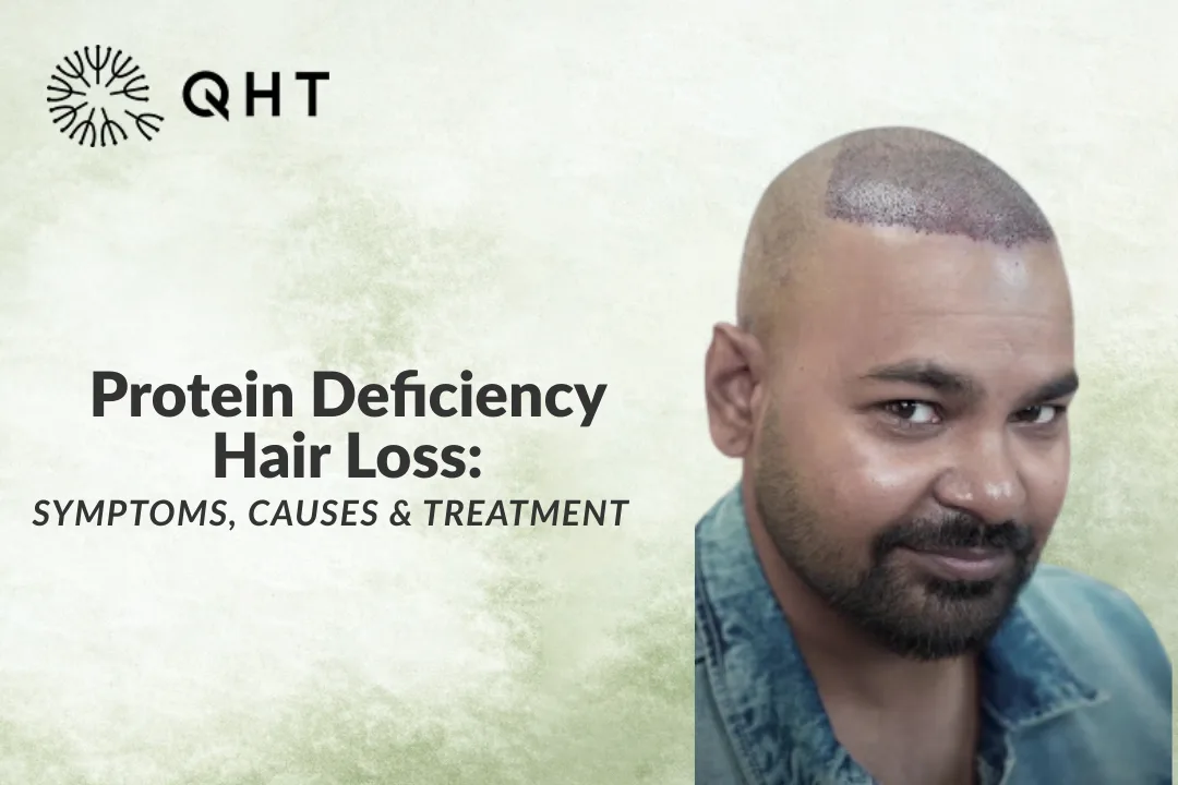 Protein Deficiency Hair Loss: Symptoms, Causes & Treatment