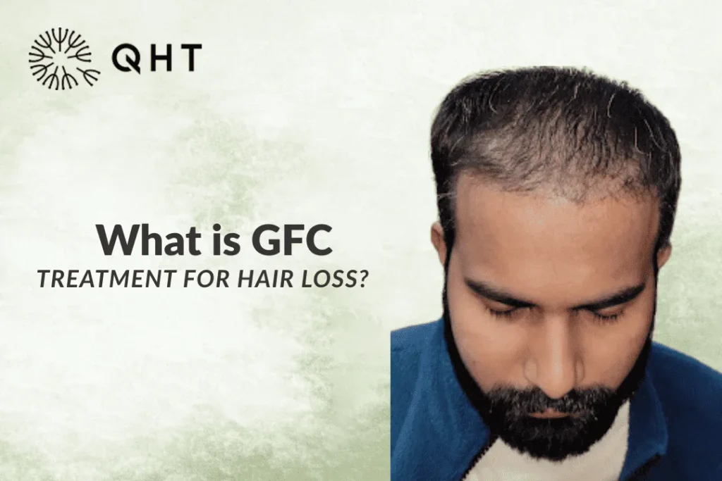 What is GFC Treatment for Hair Loss?