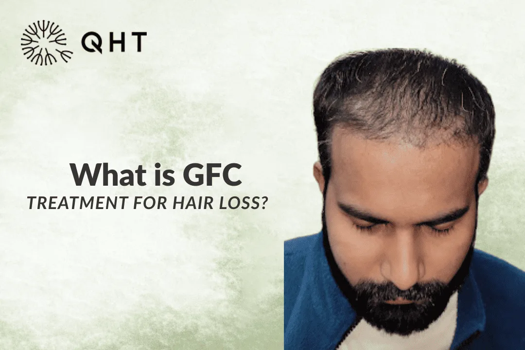 What is GFC Treatment for Hair Loss?