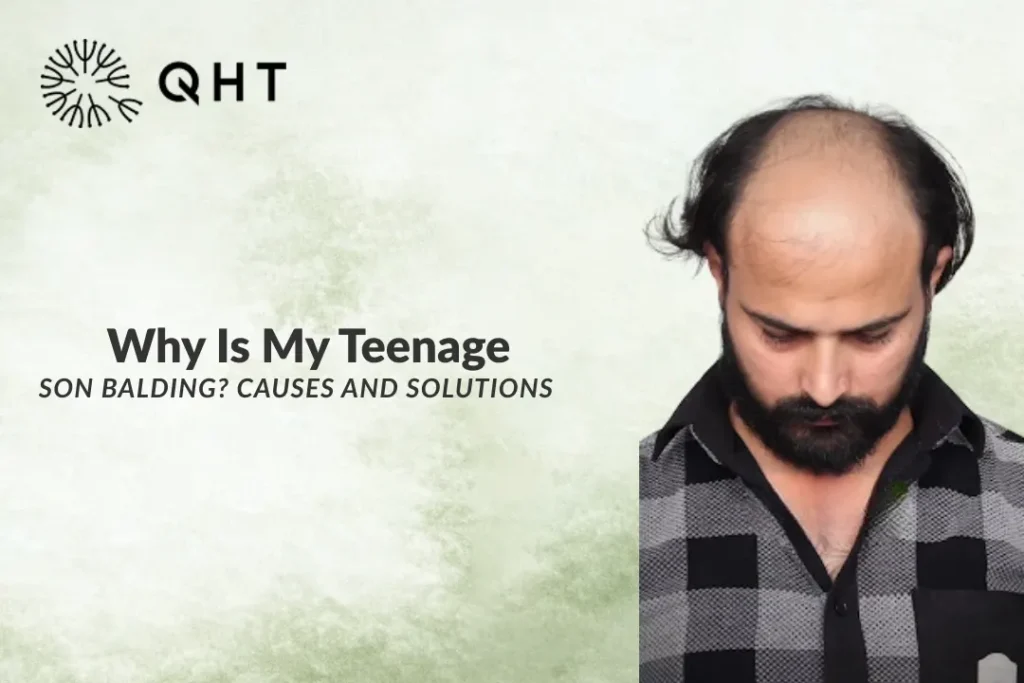 Why Is My Teenage Son Balding