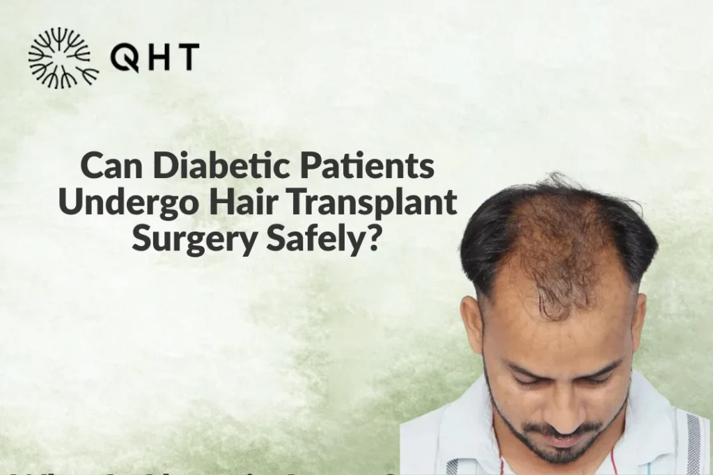 Can Diabetic Patients Undergo Hair Transplant Surgery Safely?