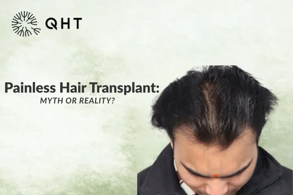 Painless Hair Transplant: Myth or Reality?