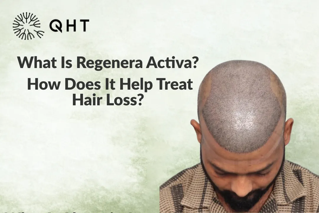 Regenera Activa: A Revolutionary Solution for Hair Loss and Regrowth